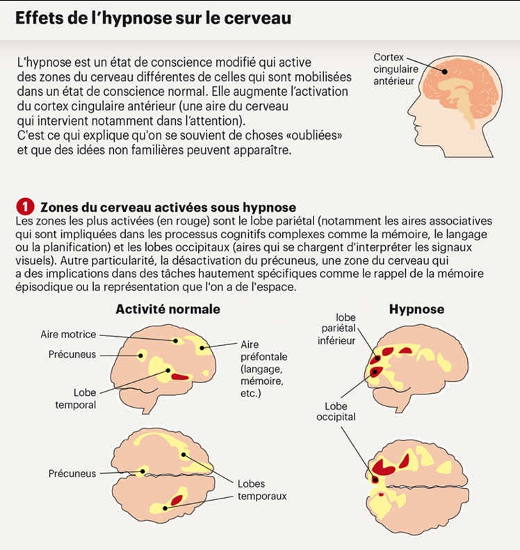 Les Effets Sur Le Cerveau Espace Intemporel